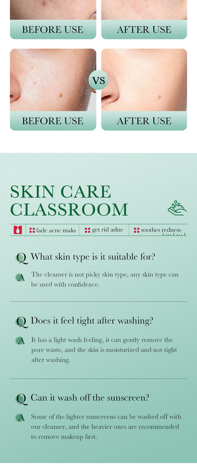 Salicylic Acid Facial Cleanser