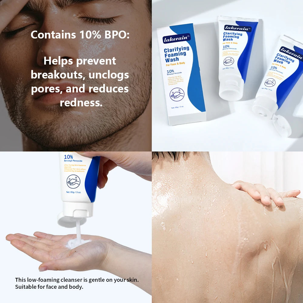 Acne Foaming Wash