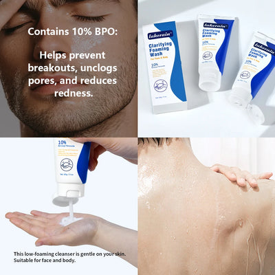 Acne Foaming Wash