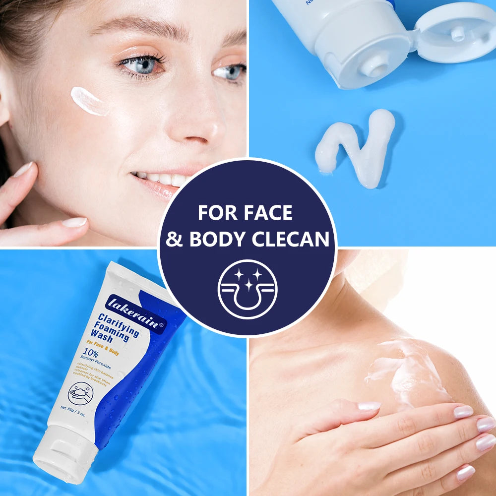 Acne Foaming Wash